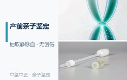 江苏胎儿如何做DNA亲子鉴定，江苏胎儿DNA鉴定需要的条件和材料有哪些